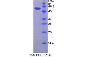 SDS-PAGE (SDS) image for Granzyme D (GZMD) (AA 33-245) protein (His tag,GST tag) (ABIN1879379)