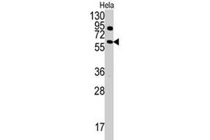 Western blot analysis of ANTXR1 polyclonal antibody  in HeLa cell line lysates (35 ug/lane). (ANTXR1 Antikörper  (Tyr382))