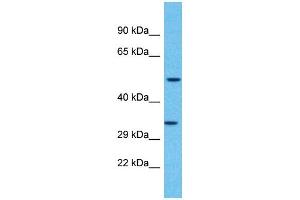 Western Blotting (WB) image for anti-Olfactory Receptor, Family 2, Subfamily F, Member 2 (OR2F2) (C-Term) antibody (ABIN2791722) (OR2F2 Antikörper  (C-Term))