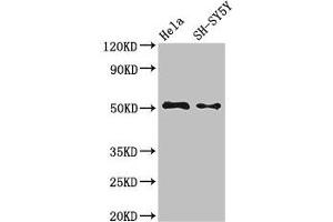 Western Blot Positive WB detected in: Hela whole cell lysate, SH-SY5Y whole cell lysate All lanes: FADS1 antibody at 3. (FADS1 Antikörper  (AA 1-121))