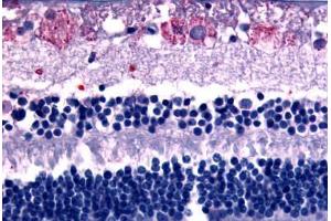 Anti-GPR75 antibody  ABIN1048869 IHC staining of human eye, retina.