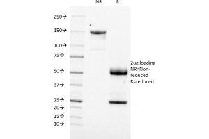 SDS-PAGE Analysis Purified CD21 / CR2 Mouse Monoclonal Antibody (CR2/1953). (CD21 Antikörper  (AA 44-196))