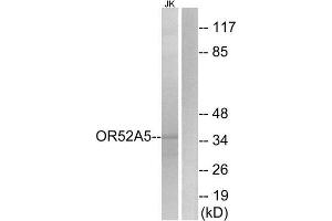 Western Blotting (WB) image for anti-Olfactory Receptor 52A5 (OR52A5) (Internal Region) antibody (ABIN1853402) (OR52A5 Antikörper  (Internal Region))