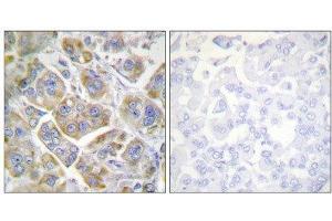 Immunohistochemistry (IHC) image for anti-Integrin beta 4 (ITGB4) (Tyr1510) antibody (ABIN5976199) (Integrin beta 4 Antikörper  (Tyr1510))