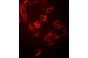 Immunofluorescent analysis of TUSC4 staining in Hela cells. (NPRL2 Antikörper)