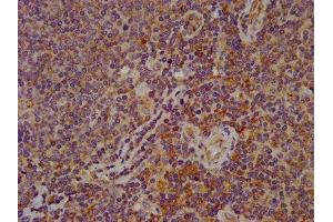 IHC image of ABIN7152326 diluted at 1:600 and staining in paraffin-embedded human lymph node tissue performed on a Leica BondTM system. (FAM62B Antikörper  (AA 567-736))