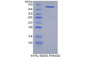 SDS-PAGE (SDS) image for Neuropilin 2 (NRP2) (AA 652-858) protein (His tag,GST tag) (ABIN1879582)