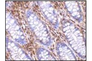 Immunohistochemistry of OMI in human colon tissue with this product at 10 μg/ml. (HTRA2 Antikörper  (C-Term))