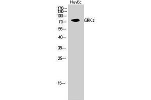 Western Blotting (WB) image for anti-Adrenergic, Beta, Receptor Kinase 1 (ADRBK1) (Ser129) antibody (ABIN3175424) (GRK2 Antikörper  (Ser129))