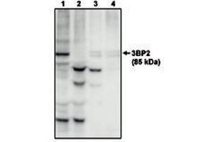 Image no. 1 for anti-SH3-Domain Binding Protein 2 (SH3BP2) antibody (ABIN291998) (SH3BP2 Antikörper)