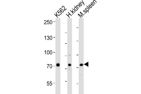 SDAD1 anticorps  (C-Term)