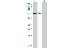 Western Blot analysis of CD44 expression in transfected 293T cell line by CD44 MaxPab polyclonal antibody.