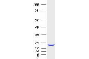 Validation with Western Blot (RAP2A Protein (Myc-DYKDDDDK Tag))