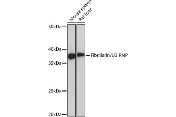Fibrillarin Antikörper