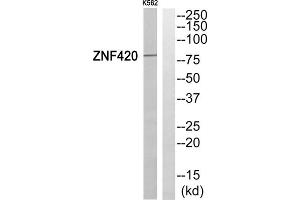 Western blot analysis of extracts from K562 cells, using ZNF420 antibody. (ZNF420 Antikörper  (Internal Region))