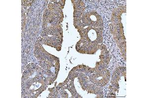 IHC analysis of FEN1 using anti-FEN1 antibody (ABIN7601619). (FEN1 Antikörper  (AA 4-300))