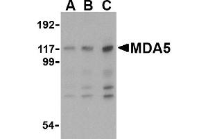 Western blot analysis of MDA5 in Daudi cell lysate with MDA5 antibody at (A) 1, (B) 2 and (C) 4 µg/mL. (IFIH1 Antikörper  (Middle Region))