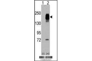 Western blot analysis of EGFR using rabbit polyclonal EGFR Antibody. (EGF Antikörper  (AA 847-876))