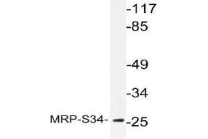 Western blot (WB) analysis of MRP-S34 antibody in extracts from Jurkat cells. (MRPS34 Antikörper)