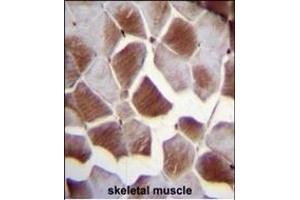 Immunohistochemistry (Paraffin-embedded Sections) (IHC (p)) image for anti-Eukaryotic Translation Initiation Factor 2B, Subunit 4 Delta, 67kDa (EIF2B4) (AA 146-175) antibody (ABIN655170)