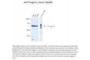 Image no. 1 for anti-Progerin (AA 604-611) antibody (ABIN1042661) (Progerin (AA 604-611) Antikörper)