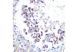Immunohistochemistry of paraffin-embedded rat testis using WISP2 Rabbit pAb (ABIN6128929, ABIN6150227, ABIN6150229 and ABIN6223338) at dilution of 1:100 (40x lens).