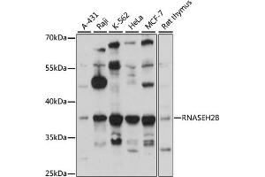 Western blot analysis of extracts of various cell lines, using RNB antibody (ABIN6133304, ABIN6146990, ABIN6146991 and ABIN6220814) at 1:3000 dilution. (RNASEH2B Antikörper  (AA 1-290))