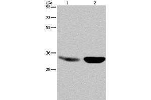 Western Blot analysis of Human fetal brain and Mouse brain tissue using MAPRE3 Polyclonal Antibody at dilution of 1:500 (MAPRE3 Antikörper)