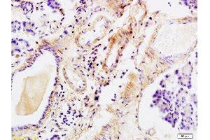 Immunohistochemistry (Paraffin-embedded Sections) (IHC (p)) image for anti-Tenascin C (TNC) (AA 1001-1100) antibody (ABIN736761)