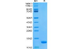 Human CCL8 on Tris-Bis PAGE under reduced condition. (CCL8 Protein (AA 24-99))