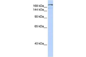 WB Suggested Anti-NFAT5 Antibody Titration:  0. (NFAT5 Antikörper  (Middle Region))