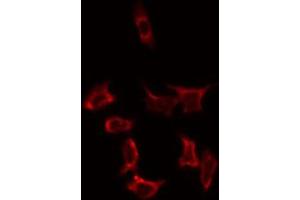 ABIN6274814 staining HeLa by IF/ICC. (SLC25A31 Antikörper  (Internal Region))