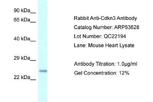 Western Blotting (WB) image for anti-Cyclin-Dependent Kinase Inhibitor 3 (CDKN3) (N-Term) antibody (ABIN2785488)