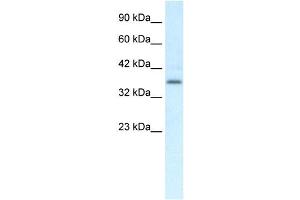 Western Blotting (WB) image for anti-Chemokine-Like Receptor 1 (CMKLR1) antibody (ABIN2460102) (CMKLR1 Antikörper)