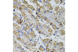 Immunohistochemistry of paraffin-embedded human stomach using GM13125 antibody (ABIN6127294, ABIN6141172, ABIN6141175 and ABIN6216319) at dilution of 1:100 (40x lens). (Pramel15 Antikörper  (AA 1-477))
