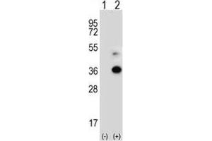 Western blot analysis of ANGPTL7 antibody and 293 cell lysate either nontransfected (Lane 1) or transiently transfected (2) with the ANGPTL7 gene. (ANGPTL7 Antikörper  (AA 300-350))