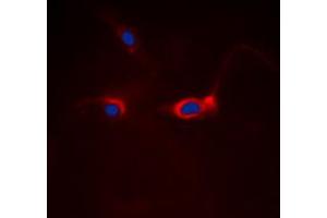 Immunofluorescent analysis of FOXO1 staining in Hela cells. (FOXO1 Antikörper  (Center))