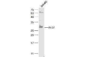PLGF Antikörper  (AA 166-221)