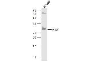 SW480 lysates probed with PLGF Polyclonal Antibody, Unconjugated  at 1:300 dilution and 4˚C overnight incubation. (PLGF Antikörper  (AA 166-221))