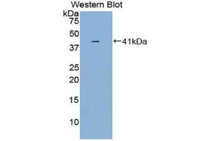 Western Blotting (WB) image for anti-Interleukin 1 Receptor, Type I (IL1R1) (AA 20-338) antibody (ABIN3209487) (IL1R1 Antikörper  (AA 20-338))