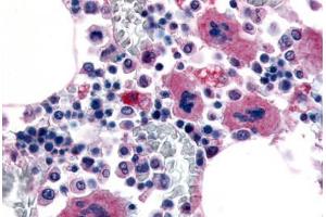 Immunohistochemistry (IHC) image for anti-Purinergic Receptor P2Y, G-Protein Coupled, 12 (P2RY12) (Extracellular Domain) antibody (ABIN1049208)