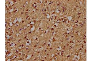IHC image of ABIN7176307 diluted at 1:300 and staining in paraffin-embedded human brain tissue performed on a Leica BondTM system. (ZFP42 Antikörper  (AA 50-256))