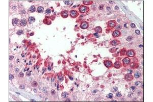 Testis, Human: Formalin-Fixed, Paraffin-Embedded (FFPE) (Reticulon 4 Antikörper)