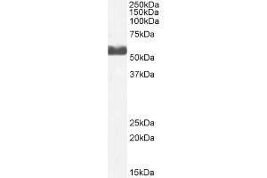 ABIN6391374 (2µg/ml) staining of Human Liver lysate (35µg protein in RIPA buffer).