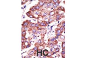 Immunohistochemistry (IHC) image for anti-Toll Interacting Protein (TOLLIP) antibody (ABIN3001486)