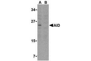 Western blot analysis of AID in Ramos whole cell lysate with AP30028PU-N AID antibody at 2 μg/ml in either the (A) absence or (B) presence of blocking peptide. (AICDA Antikörper  (C-Term))