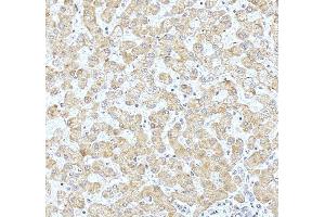 IHC analysis of WDR7 using anti-WDR7 antibody (ABIN7600939).