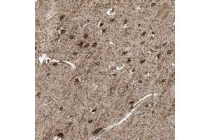 Immunohistochemical staining of human cerebral cortex with SHROOM4 polyclonal antibody  shows strong cytoplasmic positivity in neuronal cells at 1:50-1:200 dilution. (Shroom Family Member 4 (SHROOM4) Antikörper)