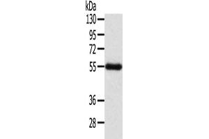Gel: 8 % SDS-PAGE, Lysate: 60 μg, Lane: Human placenta tissue, Primary antibody: ABIN7192312(SEPN1 Antibody) at dilution 1/200, Secondary antibody: Goat anti rabbit IgG at 1/8000 dilution, Exposure time: 2 minutes (Selenoprotein N Antikörper)