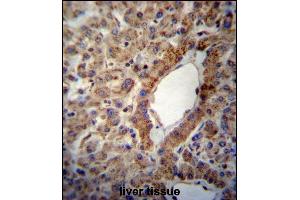 ACSS2 Antibody (Center) (ABIN657155 and ABIN2846289) immunohistochemistry analysis in formalin fixed and paraffin embedded human liver tissue followed by peroxidase conjugation of the secondary antibody and DAB staining. (ACSS2 Antikörper  (AA 261-290))